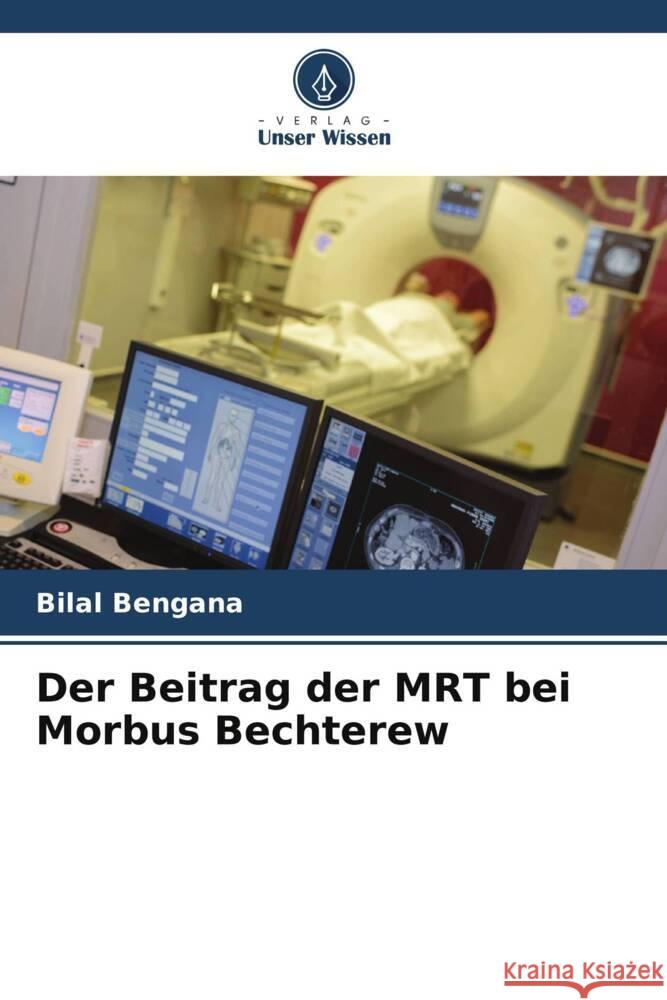 Der Beitrag der MRT bei Morbus Bechterew Bilal Bengana 9786207115587 Verlag Unser Wissen - książka