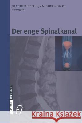 Der Enge Spinalkanal Pfeil, Joachim 9783798514645 Steinkopff - książka