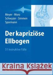 Der Kapriziöse Ellbogen: 51 Instruktive Fälle Meyer, Rainer-Peter 9783642258800 Springer - książka