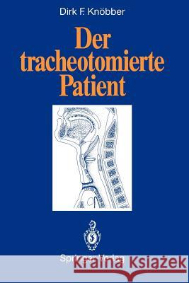 Der Tracheotomierte Patient Knöbber, Dirk F. 9783540535492 Not Avail - książka