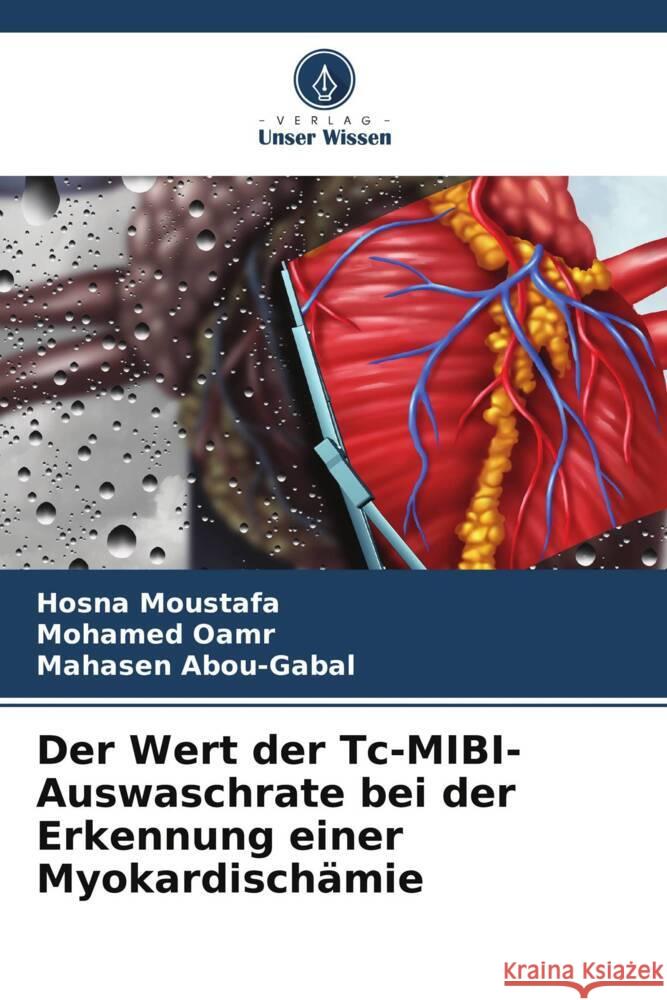 Der Wert der Tc-MIBI-Auswaschrate bei der Erkennung einer Myokardisch?mie Hosna Moustafa Mohamed Oamr Mahasen Abou-Gabal 9786206902997 Verlag Unser Wissen - książka