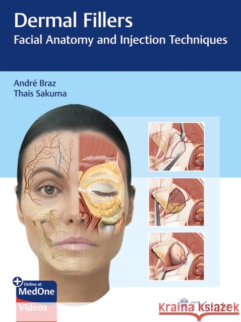 Dermal Fillers: Facial Anatomy and Injection Techniques Thais Harumi Sakuma 9783132427723 Thieme Publishing Group - książka