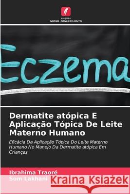 Dermatite atópica E Aplicação Tópica De Leite Materno Humano Ibrahima Traoré, Som Lakhani 9786203962390 Edicoes Nosso Conhecimento - książka