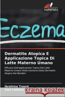 Dermatite Atopica E Applicazione Topica Di Latte Materno Umano Traor Som Lakhani 9786203962413 Edizioni Sapienza - książka