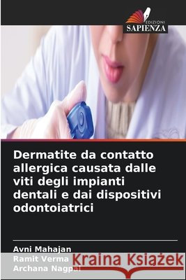 Dermatite da contatto allergica causata dalle viti degli impianti dentali e dai dispositivi odontoiatrici Avni Mahajan Ramit Verma Archana Nagpal 9786630206258 Edizioni Sapienza - książka