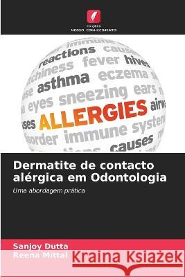 Dermatite de contacto al?rgica em Odontologia Sanjoy Dutta Reena Mittal 9786205833476 Edicoes Nosso Conhecimento - książka