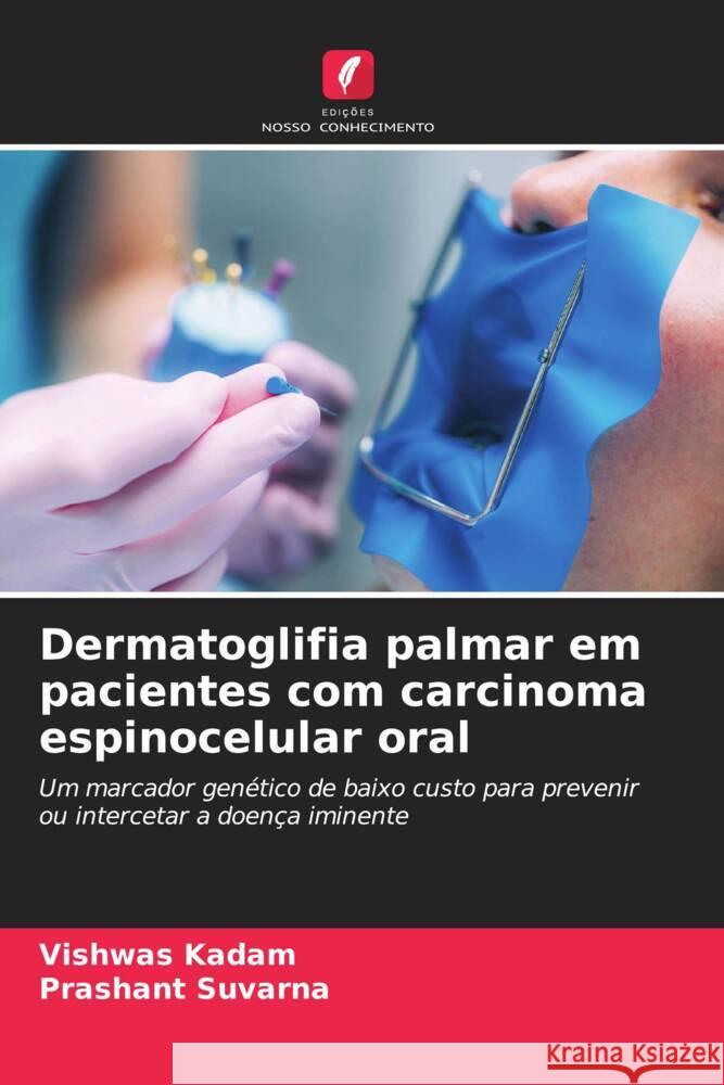 Dermatoglifia palmar em pacientes com carcinoma espinocelular oral Kadam, Vishwas, Suvarna, Prashant 9786203581263 Edições Nosso Conhecimento - książka