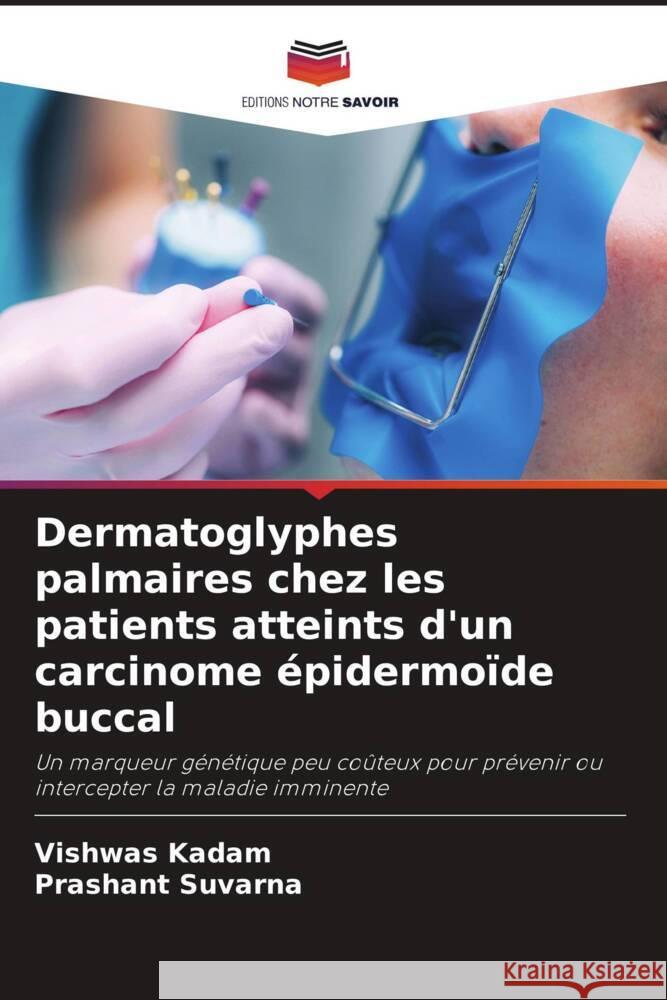 Dermatoglyphes palmaires chez les patients atteints d'un carcinome épidermoïde buccal Kadam, Vishwas, Suvarna, Prashant 9786203580808 Editions Notre Savoir - książka