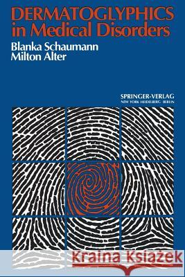 Dermatoglyphics in Medical Disorders B. Schaumann M. Alter 9783642516221 Springer - książka