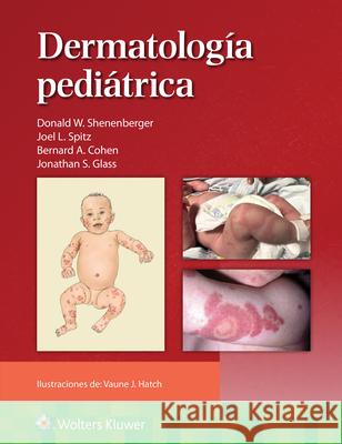 Dermatolog?a Pedi?trica Donald William Shenenberger Joel L. Spitz 9788410022973 LWW - książka