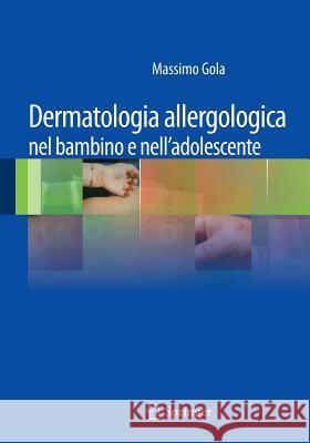 Dermatologia Allergologica Nel Bambino E Nell'adolescente Gola, Massimo 9788847025066 Springer - książka