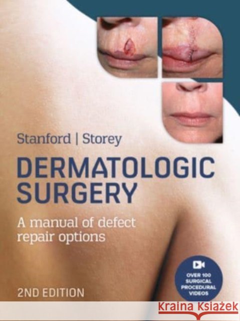 Dermatologic Surgery Leslie Storey 9781743768273 McGraw-Hill Education - książka