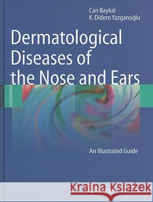 Dermatological Diseases of the Nose and Ears: An Illustrated Guide Baykal, Can 9783642015588 Springer - książka