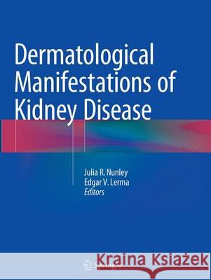 Dermatological Manifestations of Kidney Disease Julia R. Nunley Edgar V. Lerma 9781493954124 Springer - książka