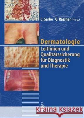 Dermatologie: Leitlinien Und Qualitätssicherung Für Diagnostik Und Therapie Berichte Von Der 39. Tagung Der Deutschen Dermatologisch Garbe, C. 9783642719752 Springer - książka