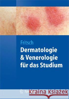 Dermatologie Und Venerologie Für Das Studium Fritsch, Peter 9783540793021 Springer, Berlin - książka