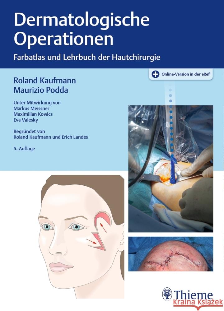 Dermatologische Operationen, m. 1 Beilage Kaufmann, Roland; Podda, Maurizio 9783132412958 Thieme, Stuttgart - książka