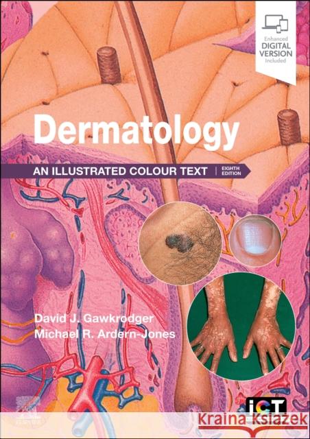 Dermatology: An Illustrated Colour Text Michael R. (Professor and Consultant Dermatologist, University of Southampton, Southampton General Hospital, Southampton 9780443249662 Elsevier - książka