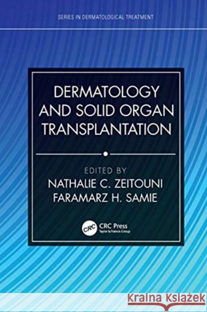 Dermatology and Solid Organ Transplantation Nathalie C. Zeitouni Faramarz H. Samie 9780367431464 CRC Press - książka