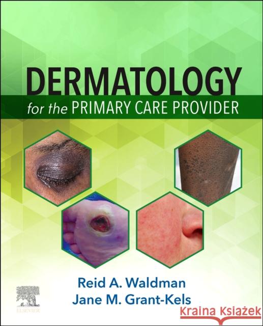 Dermatology for the Primary Care Provider Reid A. Waldman Jane M. Grant-Kels 9780323712361 Elsevier - książka