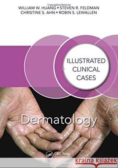 Dermatology: Illustrated Clinical Cases William W. Huang Steven Feldman Christine Ahn 9781498722889 CRC Press - książka