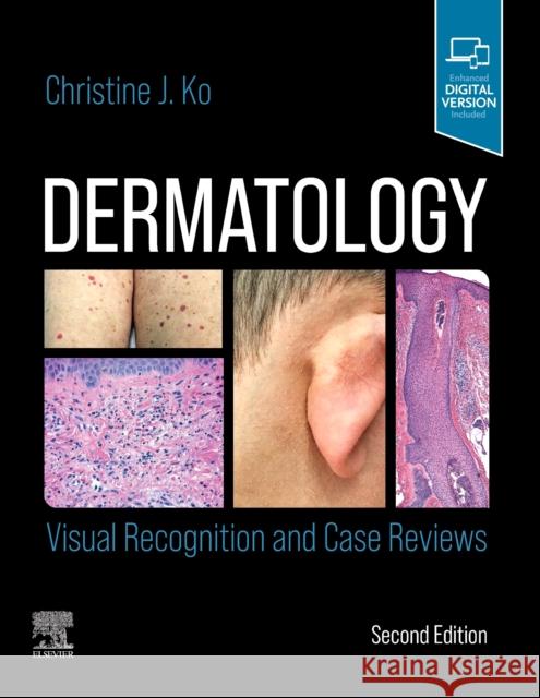 Dermatology: Visual Recognition and Case Reviews Christine (Professor of Dermatology and Pathology, Yale Medical School, New Haven, CT, USA) Ko 9780323697255 Elsevier - Health Sciences Division - książka