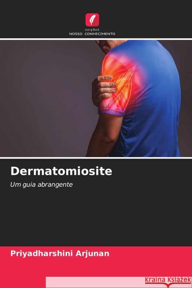 Dermatomiosite Arjunan, Priyadharshini 9786206469445 Edições Nosso Conhecimento - książka