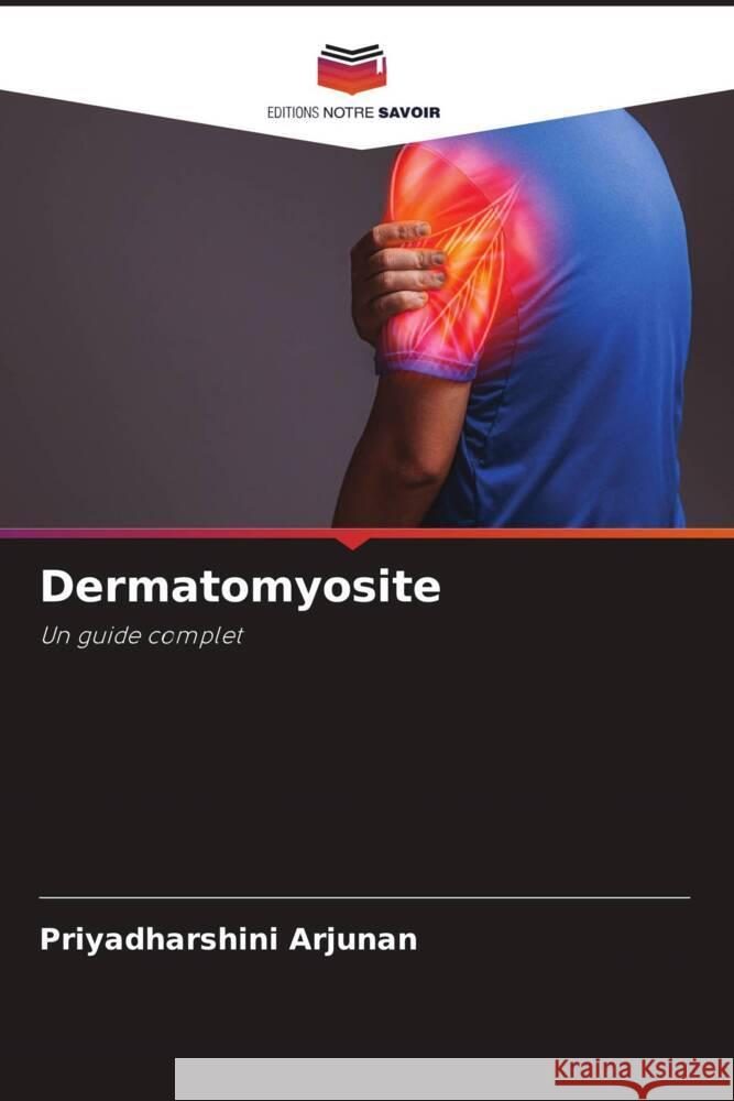 Dermatomyosite Arjunan, Priyadharshini 9786206469421 Editions Notre Savoir - książka