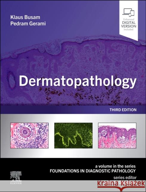 Dermatopathology Klaus J. Busam Pedram Gerami 9780323830713 Elsevier - książka