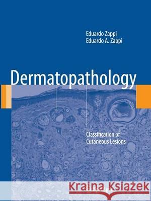 Dermatopathology: Classification of Cutaneous Lesions Zappi, Eduardo 9781447159926 Springer - książka