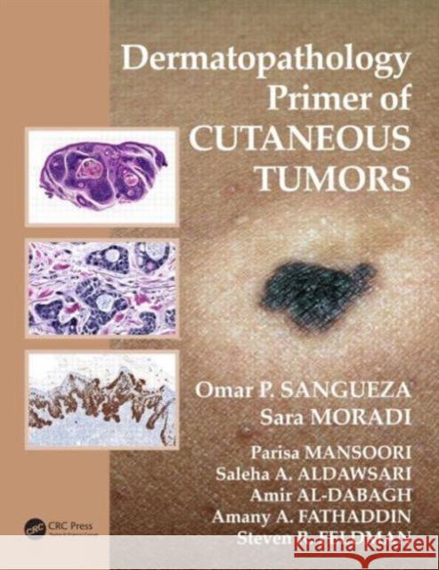 Dermatopathology Primer of Cutaneous Tumors Omar P. Sangueza Sara Moradi Parisa Mansoori 9781498703918 CRC Press - książka
