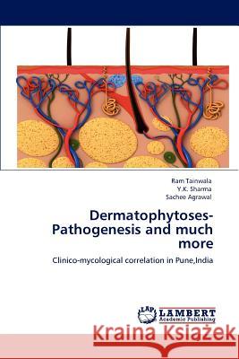 Dermatophytoses-Pathogenesis and much more Tainwala, Ram 9783848492930 LAP Lambert Academic Publishing - książka