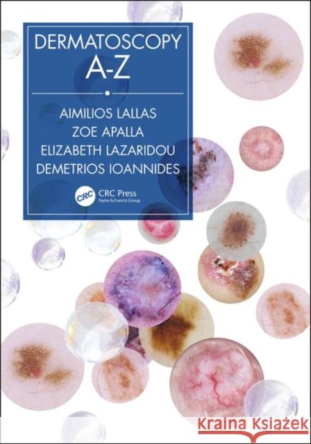 Dermatoscopy A-Z Aimilios Lallas Zoe Apalla Elizabeth Lazaridou 9780367197810 CRC Press - książka