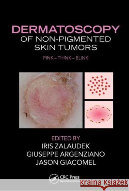 Dermatoscopy of Non-Pigmented Skin Tumors: Pink-Think-Blink Iris Zalaudek Giuseppe Argenziano Jason Giacomel 9781482237528 CRC Press - książka