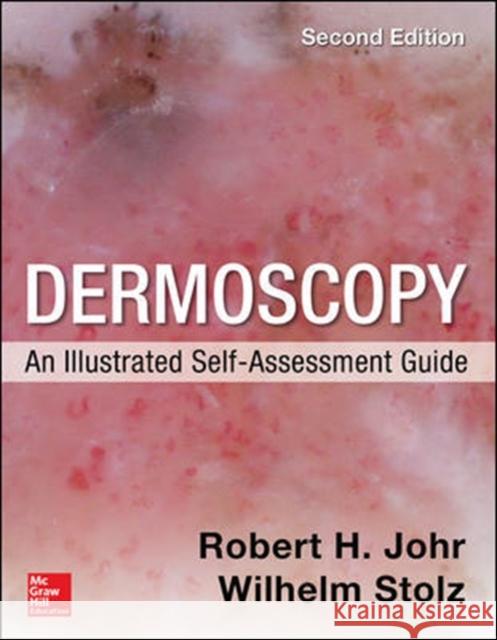 Dermoscopy: An Illustrated Self-Assessment Guide, 2/e Wilhelm Stolz 9780071834346 McGraw-Hill Education - Europe - książka