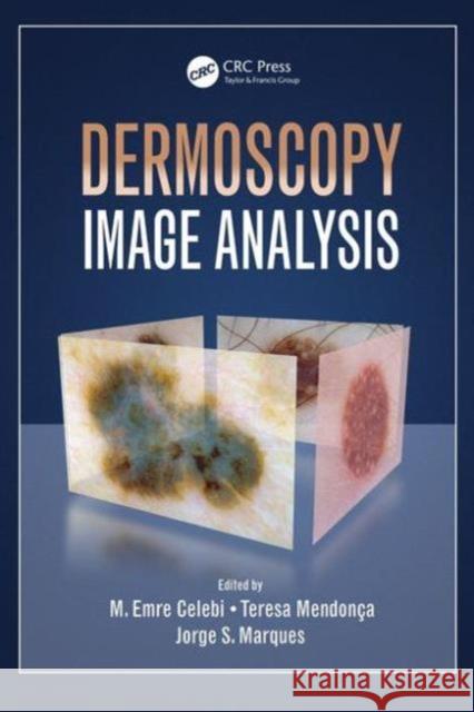 Dermoscopy Image Analysis  9781482253269 Apple Academic Press - książka