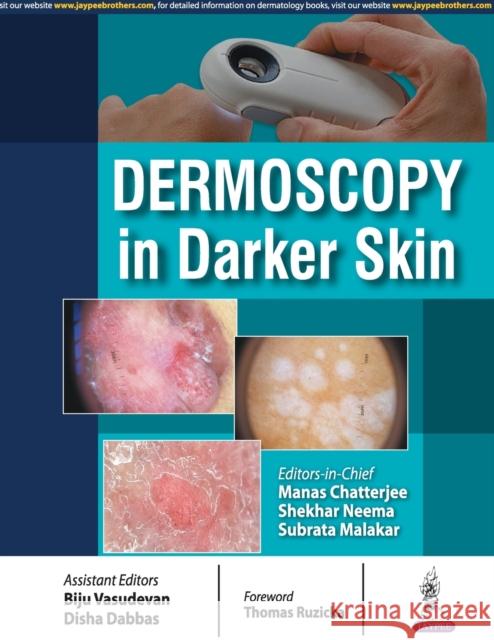 Dermoscopy in Darker Skin Manas Chatterjee 9789386322678 Jp Medical Ltd - książka