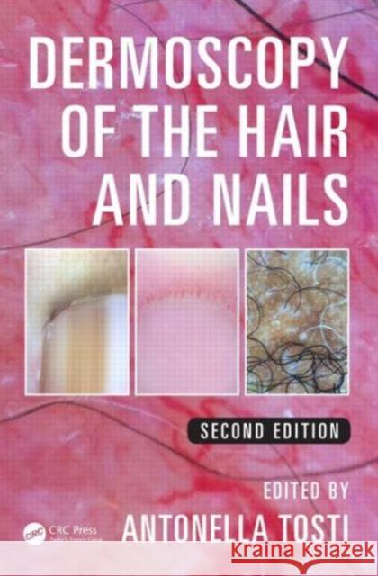 Dermoscopy of the Hair and Nails Antonella Tosti 9781482234053 CRC Press - książka