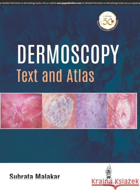 Dermoscopy: Text and Atlas Subrata Malakar 9789352703944 Jp Medical Ltd - książka