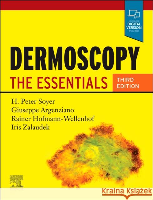 Dermoscopy: The Essentials H. Peter Soyer Giuseppe Argenziano Rainer Hofmann-Wellenhof 9780702068829 Elsevier - książka