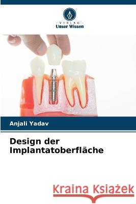 Design der Implantatoberflache Anjali Yadav   9786204417820 International Book Market Service Ltd - książka