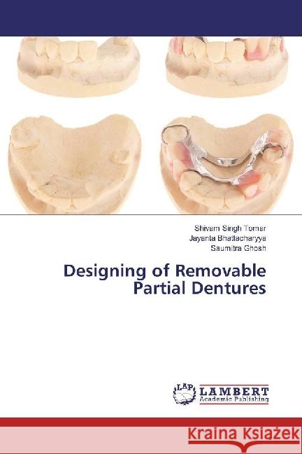 Designing of Removable Partial Dentures Tomar, Shivam Singh; Bhattacharyya, Jayanta; Ghosh, Saumitra 9783330319127 LAP Lambert Academic Publishing - książka