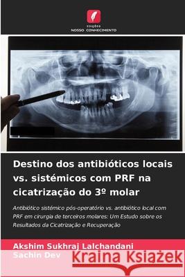 Destino dos antibióticos locais vs. sistémicos com PRF na cicatrização do 3º molar Lalchandani, Akshim Sukhraj, DEV, SACHIN 9783330846685 Edições Nosso Conhecimento - książka