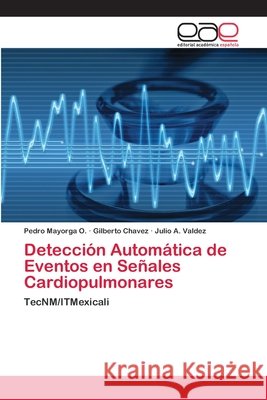 Detección Automática de Eventos en Señales Cardiopulmonares Mayorga O., Pedro 9786202170789 Novas Edicioes Academicas - książka