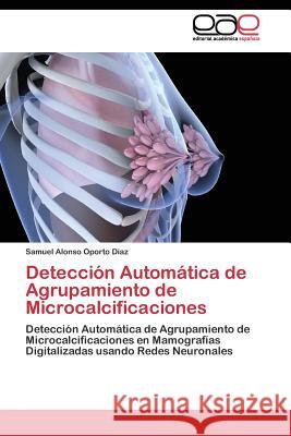 Detección Automática de Agrupamiento de Microcalcificaciones Oporto Díaz Samuel Alonso 9783844344806 Editorial Academica Espanola - książka