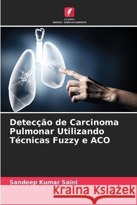 Detecção de Carcinoma Pulmonar Utilizando Técnicas Fuzzy e ACO Sandeep Kumar Saini 9786205291245 Edicoes Nosso Conhecimento - książka