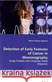 Detection of Early Features of Cancer in  Mammography : Image Analysis and Computer Aided Diagnosis Linguraru, Marius George 9783639158540 VDM Verlag Dr. Müller - książka