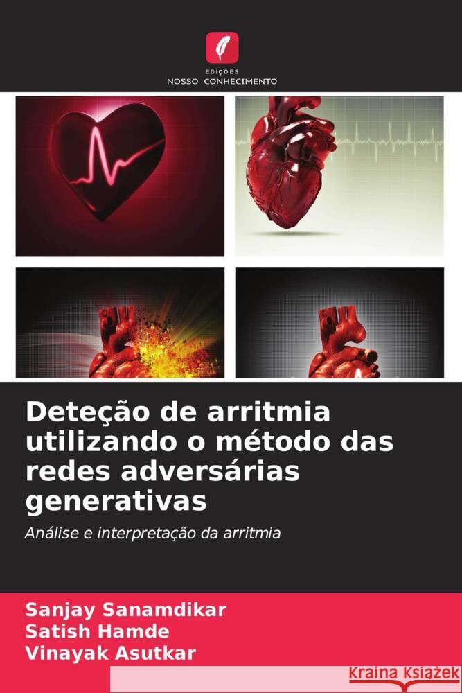 Dete??o de arritmia utilizando o m?todo das redes advers?rias generativas Sanjay Sanamdikar Satish Hamde Vinayak Asutkar 9786206959847 Edicoes Nosso Conhecimento - książka
