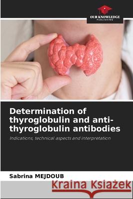 Determination of thyroglobulin and anti-thyroglobulin antibodies MEJDOUB, Sabrina 9786208873233 Our Knowledge Publishing - książka