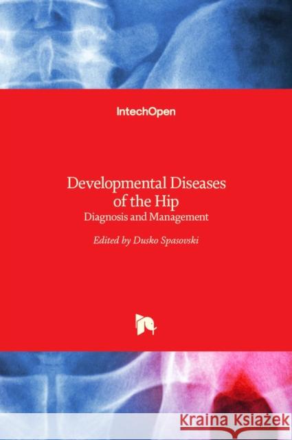 Developmental Diseases of the Hip: Diagnosis and Management Dusko Spasovski 9789535130734 Intechopen - książka